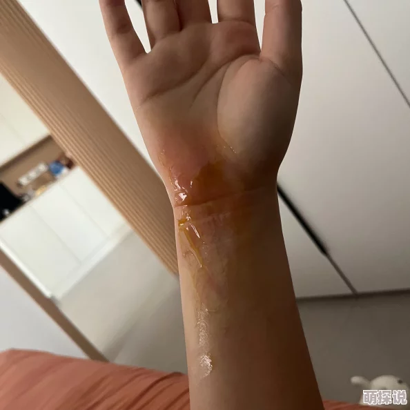 啊啊啊好痛小明在家尝试做蛋糕，结果烫到了手
