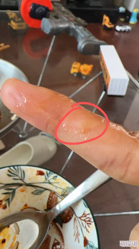 啊啊啊好痛小明在家尝试做蛋糕，结果烫到了手