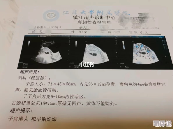 中国孕妇孕交xxxxx过程记录分享至第8周胎儿发育情况良好