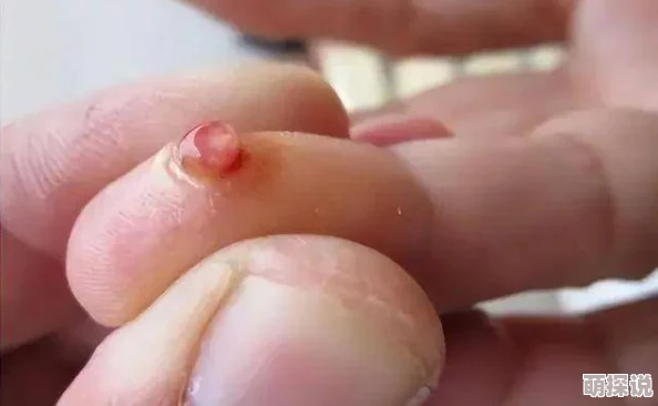 人鱼受喷汁红肿NP双性深海囚笼扩张受孕产卵进行中