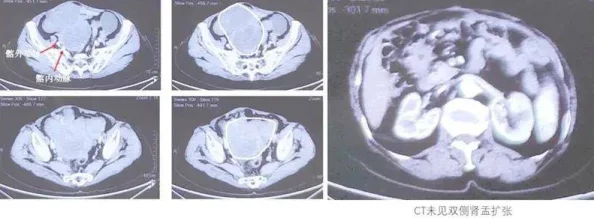 人鱼受喷汁红肿NP双性深海囚笼扩张受孕产卵进行中