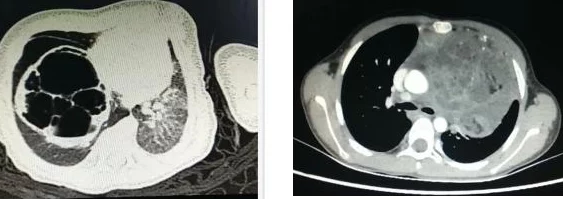 男人边摸边吃奶边做下面这种行为是对女性的极大不尊重和伤害,可能构成性侵犯 男人边摸边吃奶边做下面这种行为是对女性的极大不尊重和伤害,可能构成性侵犯